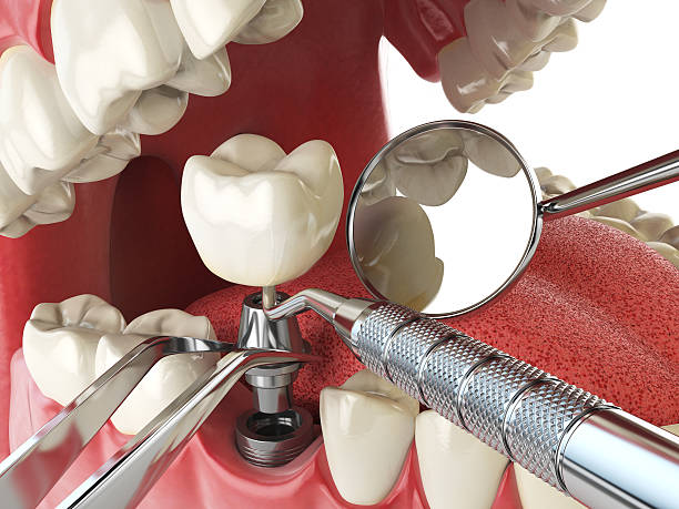 Best Walk-In Emergency Dentist in Booker, TX